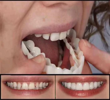 2Pcs/Set Козметична протеза Горна/долна Зъбна покривка Избелване на зъби Брекети Симулация Ортодонтски брекети Инструменти за орална хигиена